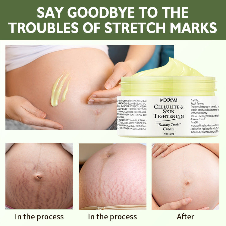 Stretch Mark Cream for Skin Recovery Care