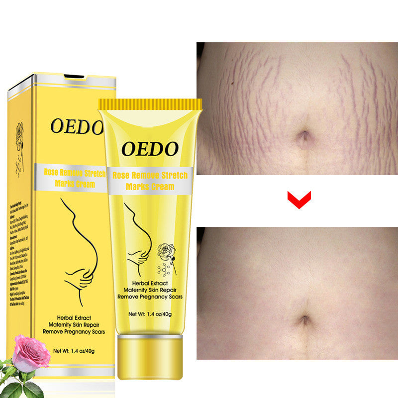 Stretch Mark Removal Cream Anti Wrinkle Care
