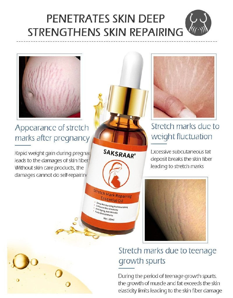 Stretch Mark Essential Oil for Skin Care