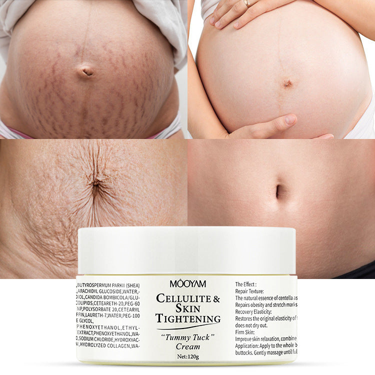 Stretch Mark Cream for Skin Recovery Care