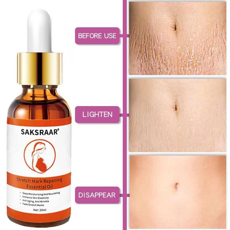 Stretch Mark Essential Oil for Skin Care